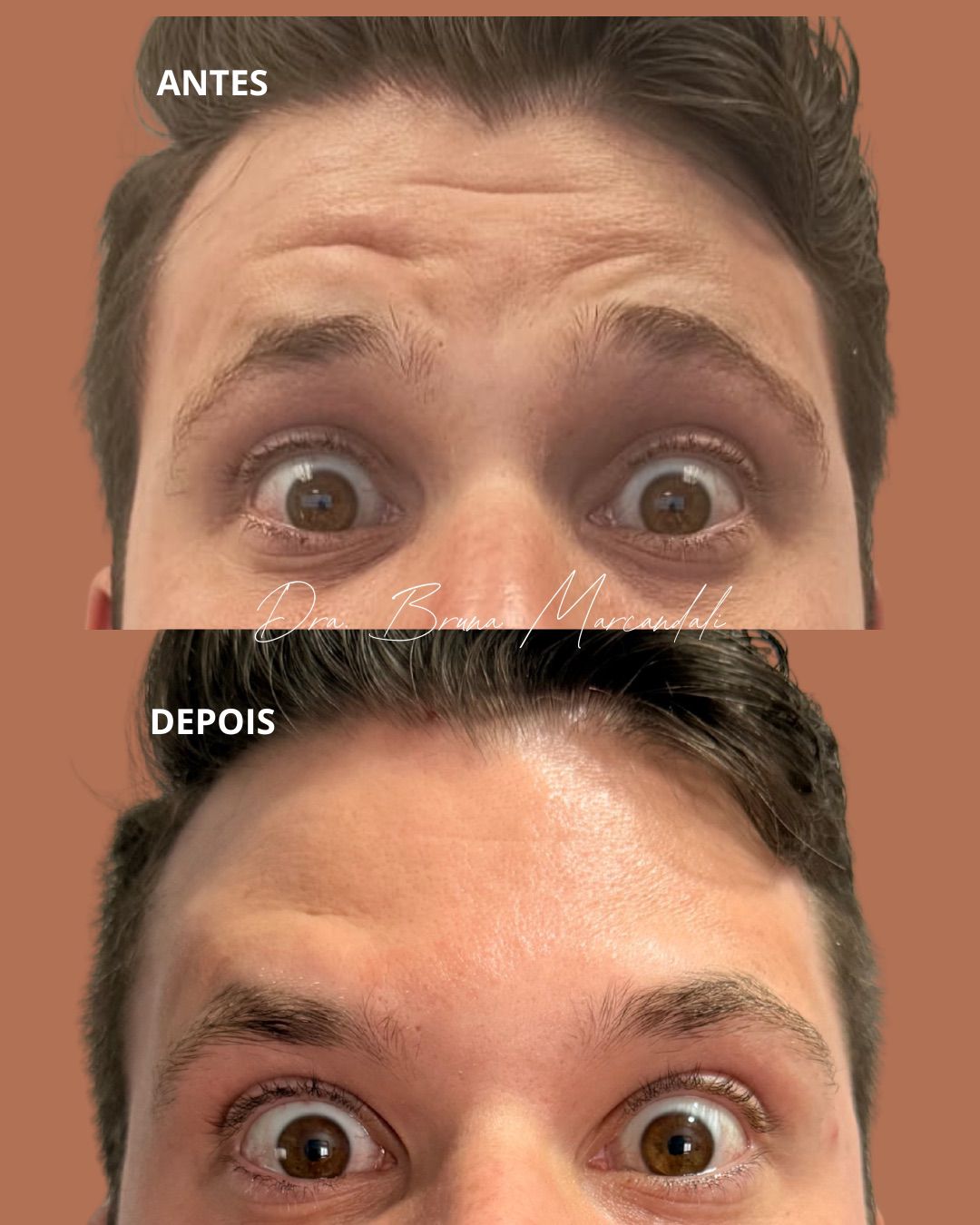 Resultado  — imagem 1