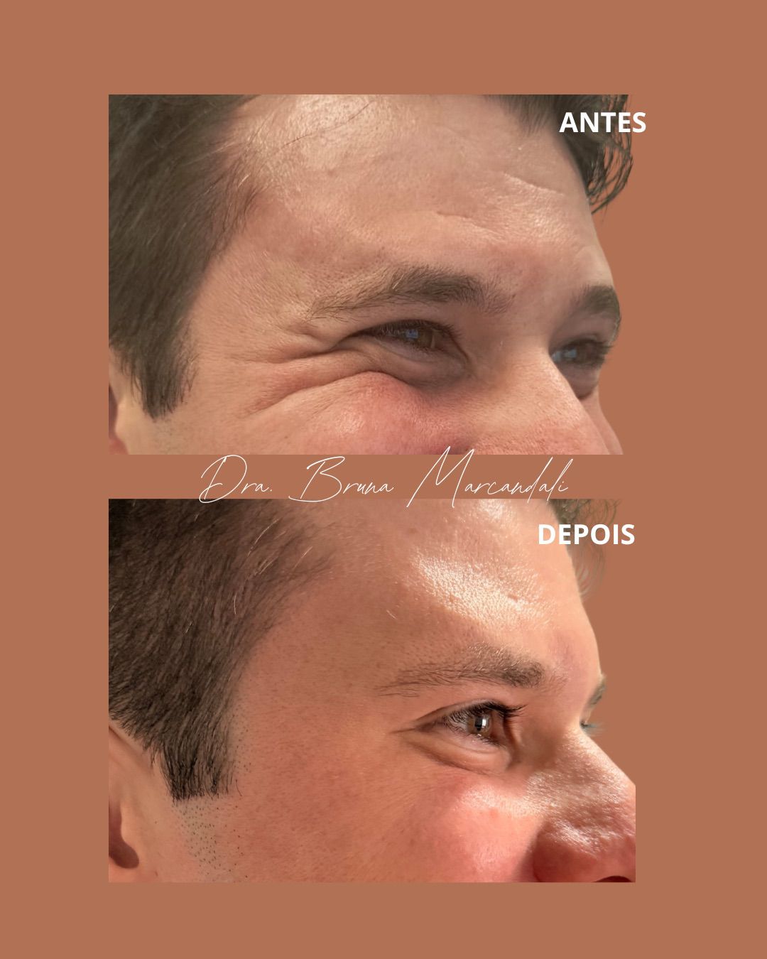 Resultado  — imagem 2